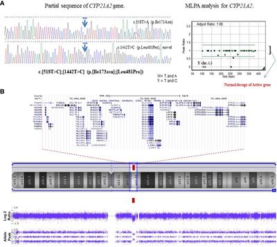 Case report: Development of central precocious puberty in a girl with late-diagnosed simple virilizing congenital adrenal hyperplasia complicated with Williams syndrome